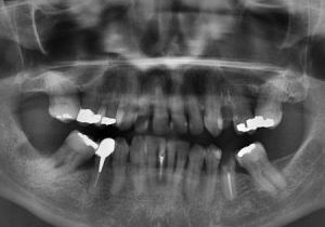 tooth-1462410_1280-450x450